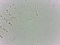 Calohypsibius ornatus image