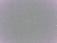 Calohypsibius ornatus image