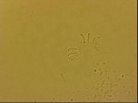 Echiniscoides sigismundi image