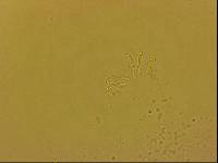 Echiniscoides sigismundi image