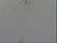 Echiniscoides sigismundi image