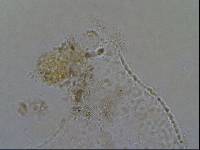 Echiniscoides sigismundi image