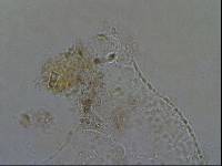 Echiniscoides sigismundi image