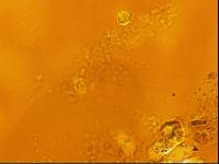 Echiniscoides sigismundi image