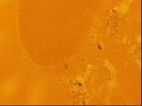 Echiniscoides sigismundi image