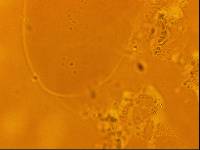 Echiniscoides sigismundi image