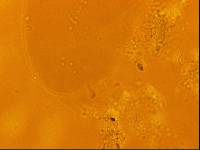Echiniscoides sigismundi image