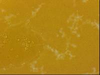 Echiniscoides sigismundi image
