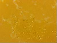 Echiniscoides sigismundi image
