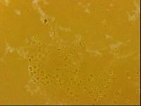 Echiniscoides sigismundi image