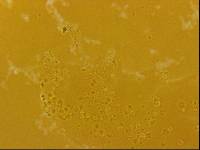 Echiniscoides sigismundi image