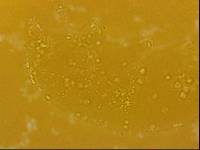 Echiniscoides sigismundi image