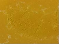 Echiniscoides sigismundi image
