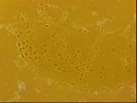 Echiniscoides sigismundi image