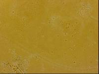 Echiniscoides sigismundi image