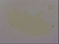 Echiniscoides sigismundi image