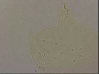 Echiniscoides sigismundi image