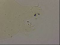 Echiniscoides sigismundi image
