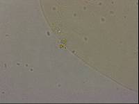 Echiniscoides sigismundi image