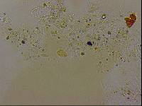 Echiniscoides sigismundi image
