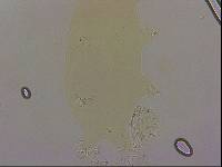 Echiniscoides sigismundi image