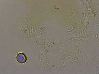 Echiniscoides sigismundi image