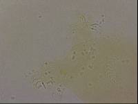 Echiniscoides sigismundi image