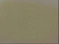 Echiniscoides sigismundi image