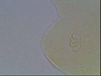 Media resource of Echiniscus baius