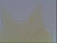 Echiniscus baius image