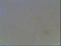 Echiniscus baius image