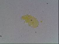 Echiniscus kerguelensis image