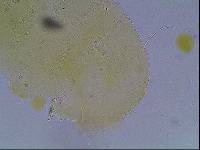 Echiniscus kerguelensis image