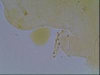 Media resource of Echiniscus kerguelensis