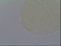 Hypechiniscus gladiator image
