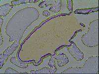 Hypechiniscus gladiator image