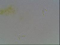 Hypsibius arcticus image