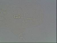 Hypsibius arcticus image