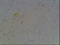 Hypsibius arcticus image