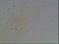 Hypsibius arcticus image