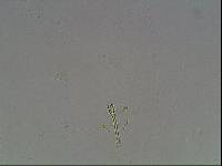 Hypsibius arcticus image
