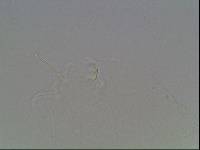 Hypsibius arcticus image