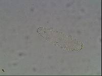 Ramazzottius baumanni image
