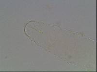 Ramazzottius baumanni image