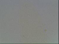 Ramazzottius baumanni image