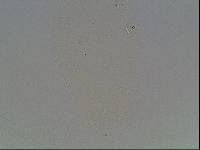 Ramazzottius baumanni image