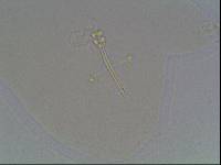 Hypsibius calcaratus image