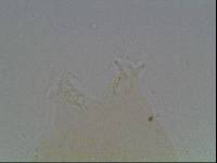 Hypsibius calcaratus image