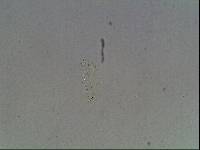 Hypsibius calcaratus image