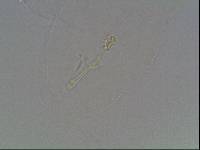 Hypsibius calcaratus image